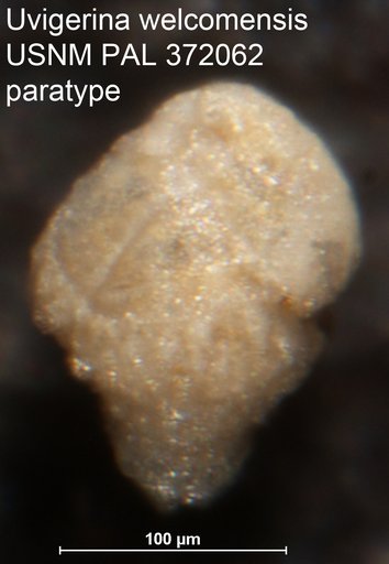 Uvigerina welcomensis Mallory, 1959