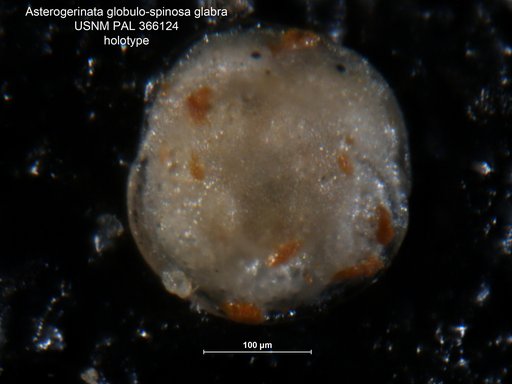 Asterigerinata globulospinosa var. glabra Bermudez, 1952
