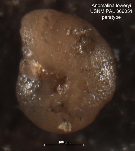 Anomalina loweryi Mallory, 1959