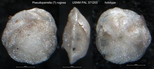 Pseudoparrella ? rugosa Phleger & Parker, 1951
