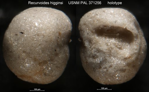 Recurvoides higginsi Brönnimann, 1953