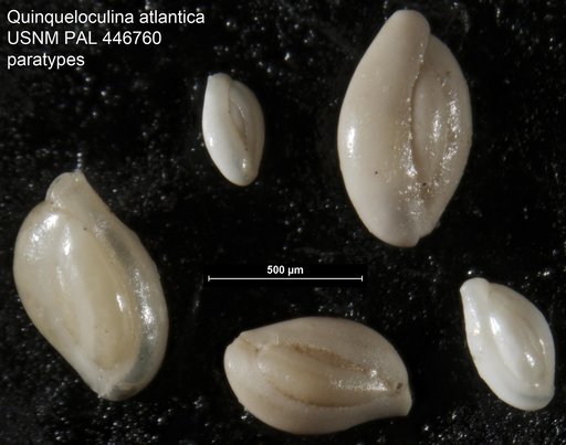 Quinqueloculina atlantica Boltovskoy, 1957