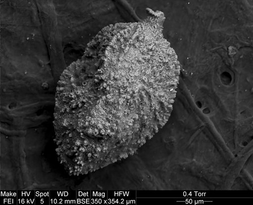 Trifarinella atlantica Watanabe, 1989