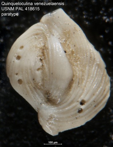 Quinqueloculina venezuelaensis Bermúdez & Seiglie, 1963
