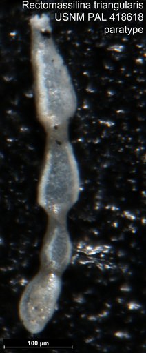 Rectomassilina triangularis Seiglie, 1965