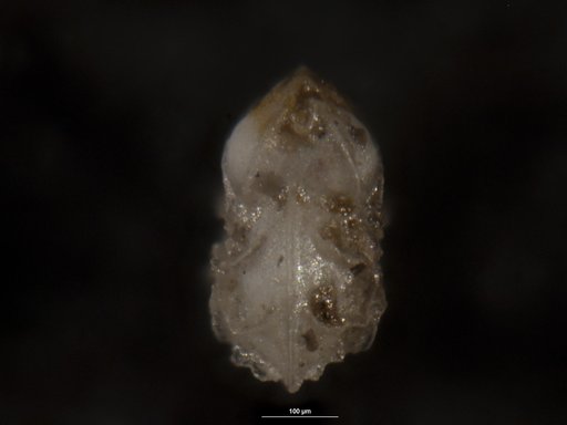 Robulus pseudo-costatus inornatus Kline, 1943