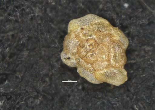 Cymbalopora tobagoensis Brönnimann, 1949