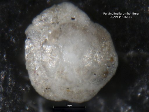 Pulvinulinella umbonifera Cushman, 1933