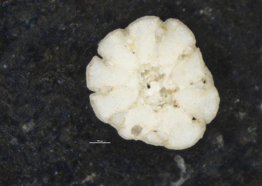 Cymbalopora poeyi var. bradyi Cushman, 1915
