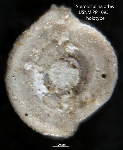 Spiroloculina orbis Cushman, 1921