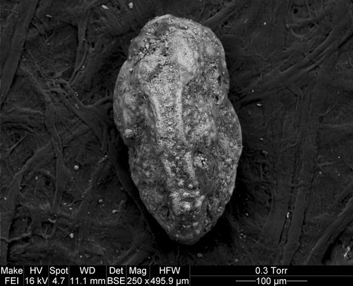 Pseudouvigerina sinaensis Said & Kenawy, 1956