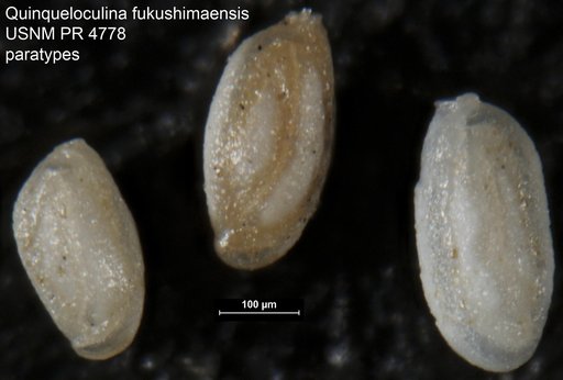 Quinqueloculina fukushimaensis Takayanagi, 1955