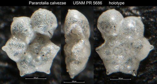 Pararotalia calvezae Loeblich & Tappan Loeblich, 1957