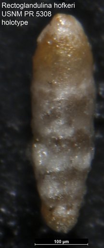 Rectoglandulina hofkeri Said & Barakat, 1958