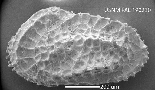 Acanthocythereis siegrlstae (Schmidt, 1948)