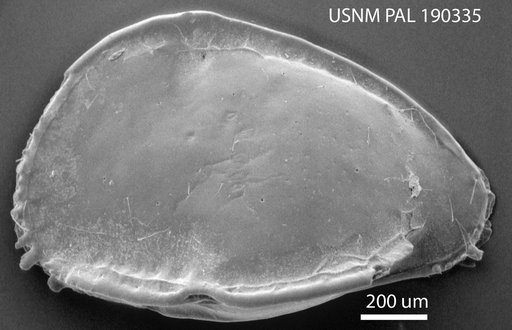 Pterygocythere sp. 1