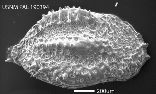 Cythere sulcatoperforata Brady, 1880