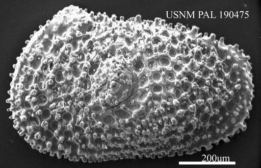 Cythere circumdentata Brady, 1880