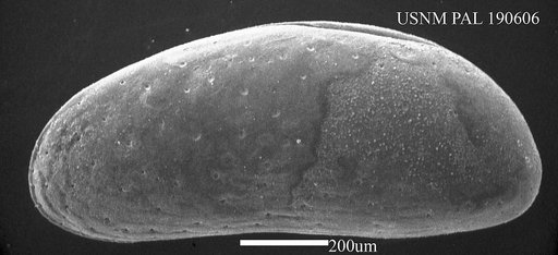 Neocytherideis sp