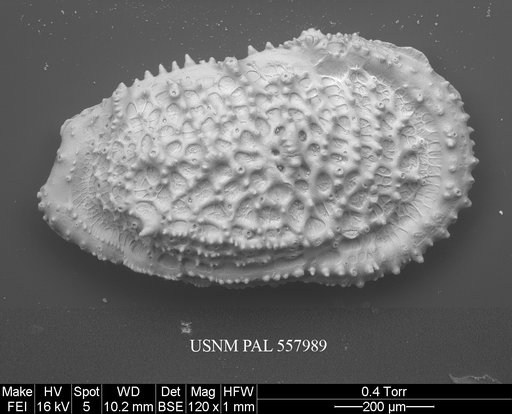 Pennyella rexi Yasuhara et al., 2013