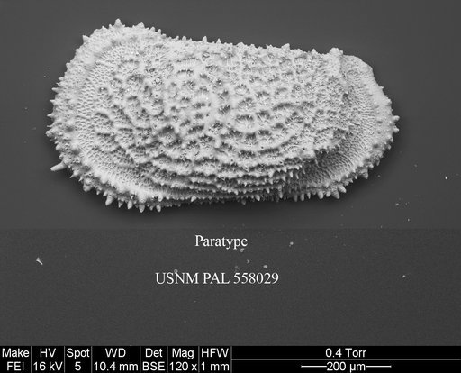 Pennyella iani Yasuhara et al., 2013