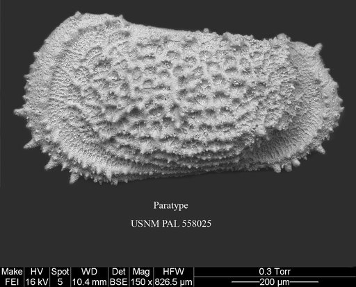 Pennyella iani Yasuhara et al., 2013