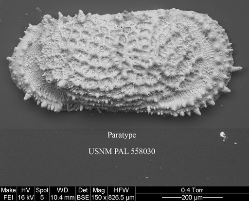 Pennyella iani Yasuhara et al., 2013