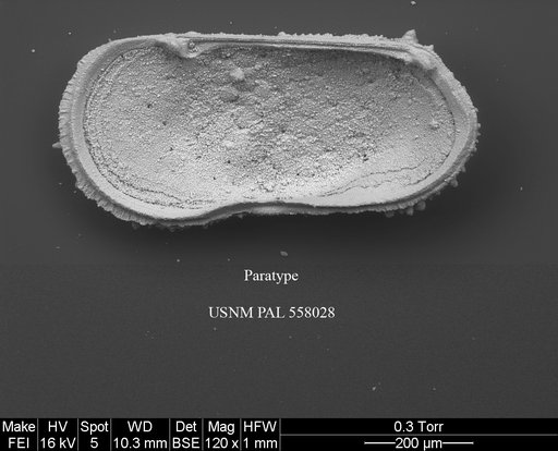 Pennyella iani Yasuhara et al., 2013