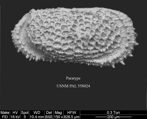 Pennyella iani Yasuhara et al., 2013