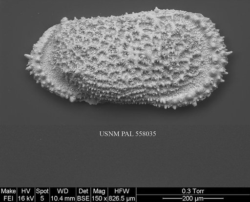 Pennyella iani Yasuhara et al., 2013