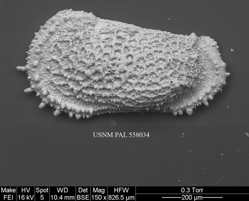 Pennyella iani Yasuhara et al., 2013