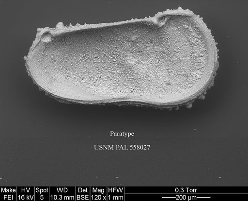 Pennyella iani Yasuhara et al., 2013