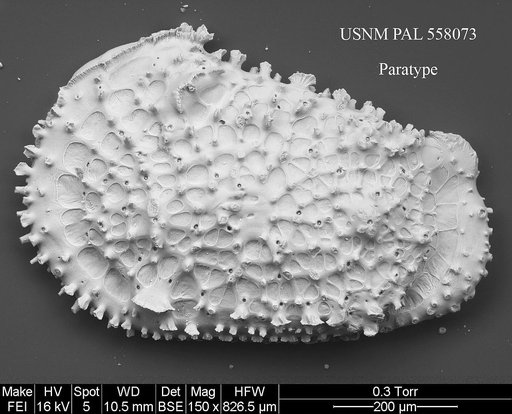 Rugocythereis zarikiani Yasuhara et al., 2013