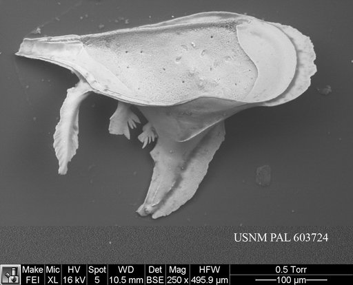 Pedicythere atroposopetasi Yasuhara et al., 2009