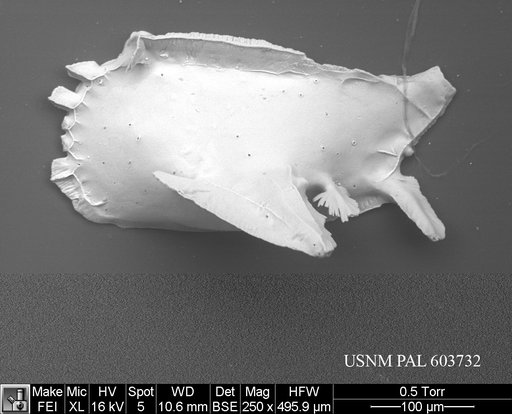 Pedicythere kennettopetasi Yasuhara et al., 2009