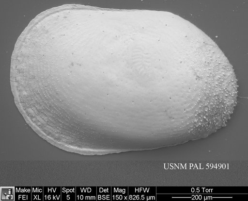 Cytherella robusta Colalongo & Pasini, 1980
