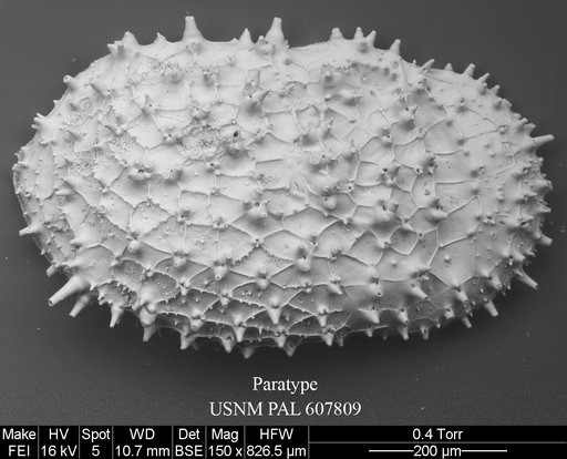 Taracythere ayressoabyssora Yasuhara et al., 2015