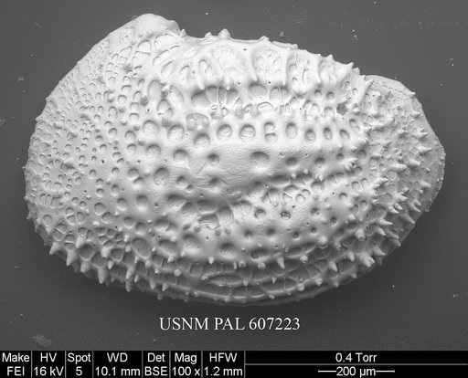 Protocythere sulcatoperforata (Brady, 1880)