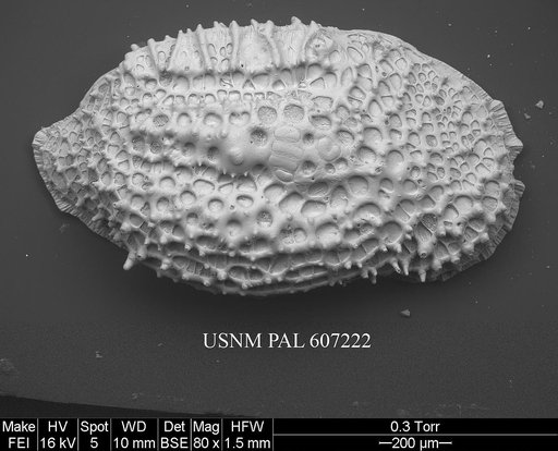 Protocythere sulcatoperforata (Brady, 1880)