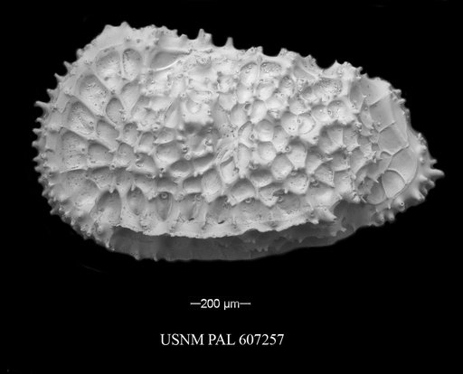 Agrenocythere hazeli (Van Den Bold, 1946)