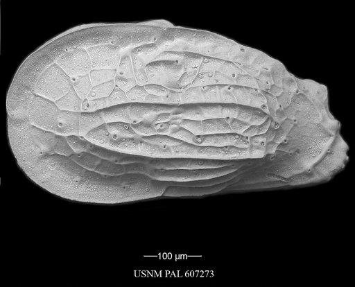 Ambocythere cf. ramosa Van Den Bold, 1965