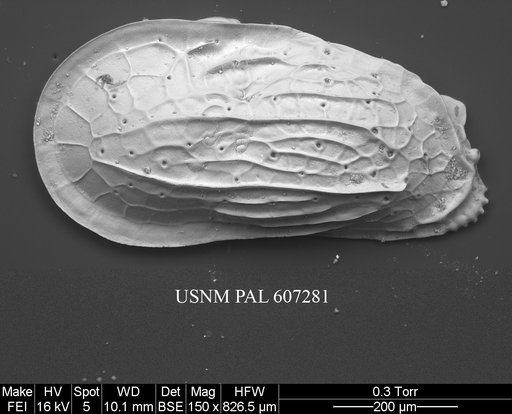 Ambocythere whatleyi Yasuhara et al., 2015