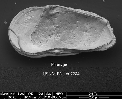 Ambocythere whatleyi Yasuhara et al., 2015