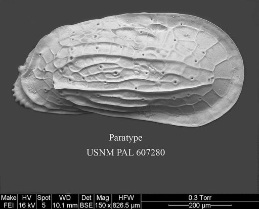 Ambocythere whatleyi Yasuhara et al., 2015