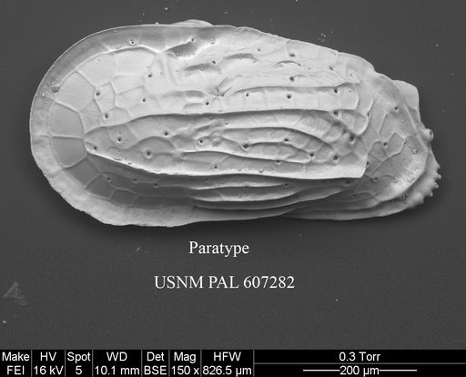 Ambocythere whatleyi Yasuhara et al., 2015