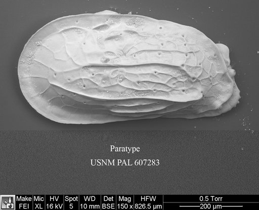 Ambocythere whatleyi Yasuhara et al., 2015