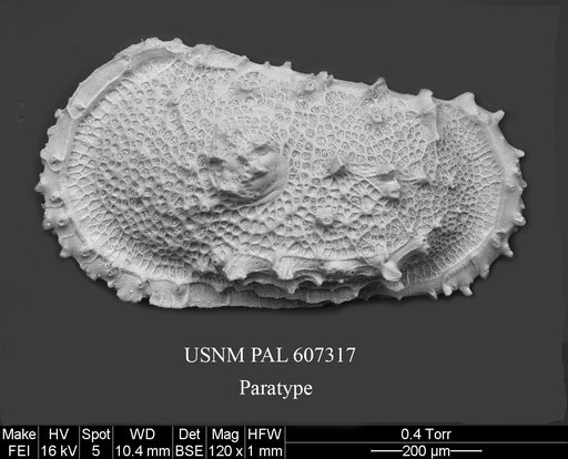 Atlanticythere bensoni Yasuhara et al., 2015