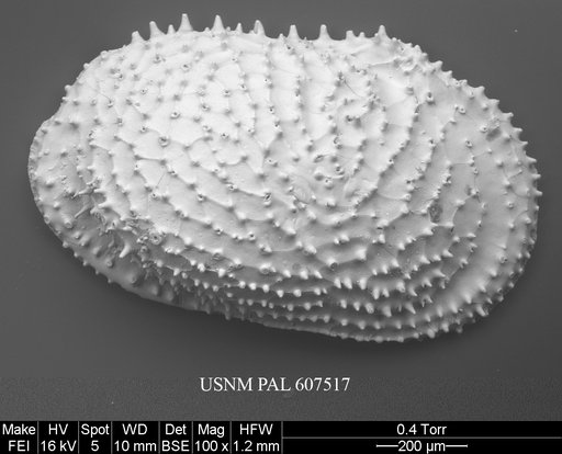 Echinocythereis echinata (Sars, 1866)