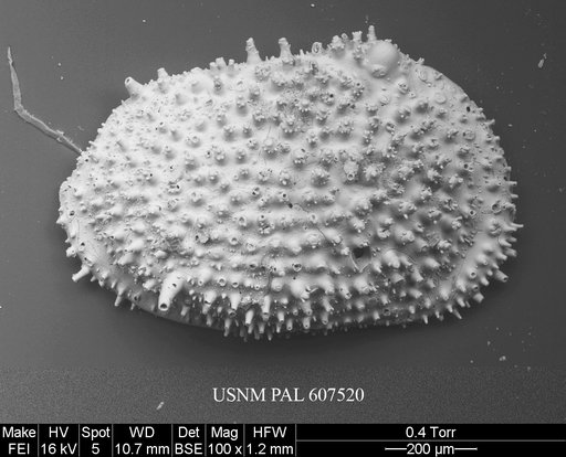 Echinocythereis margaritifera (Brady, 1870)