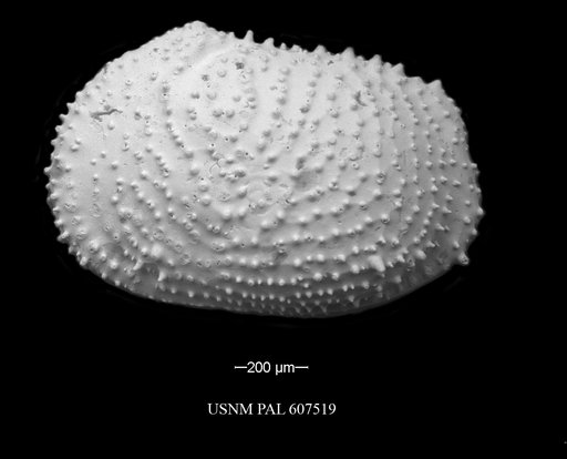 Echinocythereis echinata (Sars, 1866)